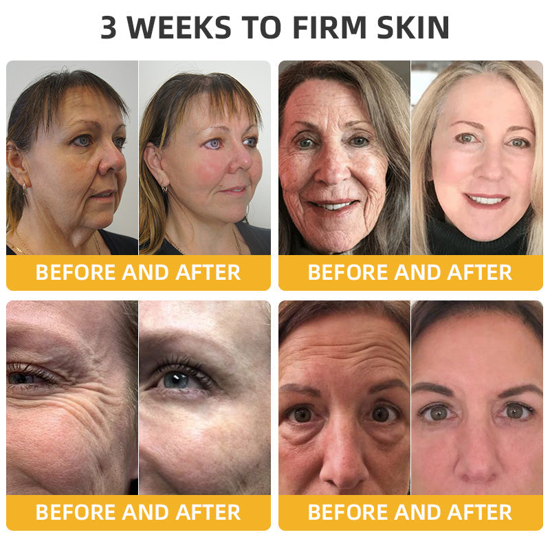 70%𝐇𝐞𝐚𝐥𝐫𝐢𝐳𝐞® 𝐏𝐃𝐑𝐍 𝐍𝐀𝐃+ 𝐑𝐞𝐠𝐞𝐧𝐞𝐫𝐚𝐭𝐢𝐯𝐞 𝐑𝐞𝐩𝐚𝐢𝐫 𝐋𝐨𝐭𝐢𝐨𝐧 𝐑𝐄𝐂𝐎𝐌𝐌𝐄𝐍𝐃𝐒🗽(🔥55% Off for a Limited Time!)