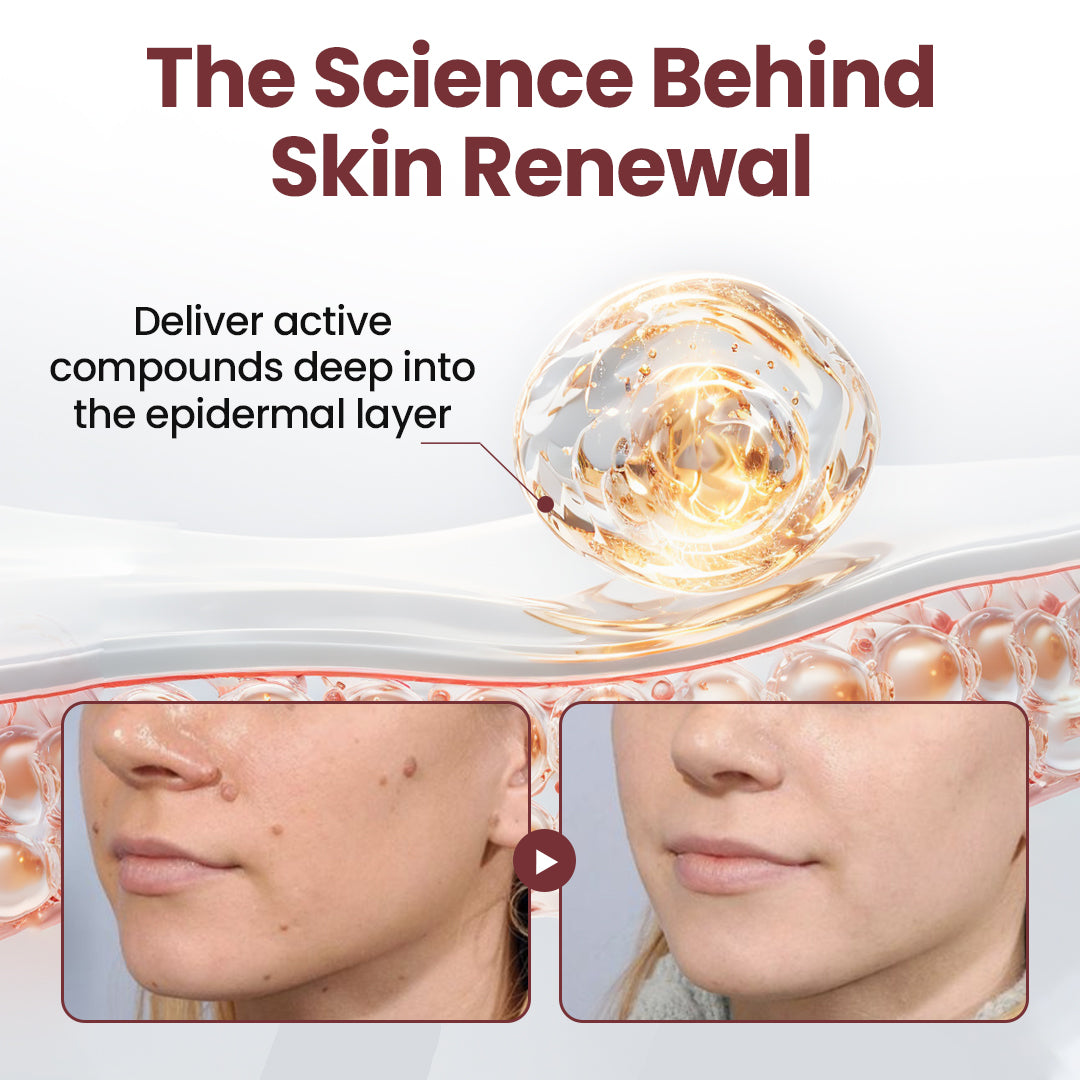 70% 𝑶𝒇𝒇𝒊𝒄𝒊𝒂𝒍 𝒔𝒕𝒐𝒓𝒆📢𝑪𝒖𝒓𝒆𝑽𝒊𝒗𝒐® KeraErase Dual-Action Renewal Cream