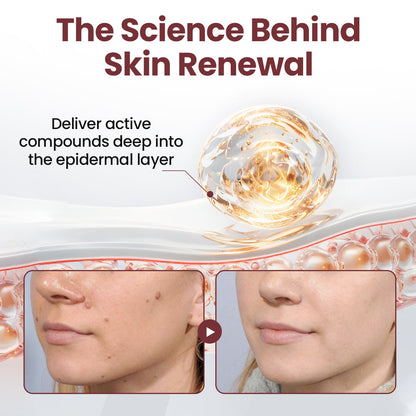 70% 𝑶𝒇𝒇𝒊𝒄𝒊𝒂𝒍 𝒔𝒕𝒐𝒓𝒆📢𝑪𝒖𝒓𝒆𝑽𝒊𝒗𝒐® KeraErase Dual-Action Renewal Cream