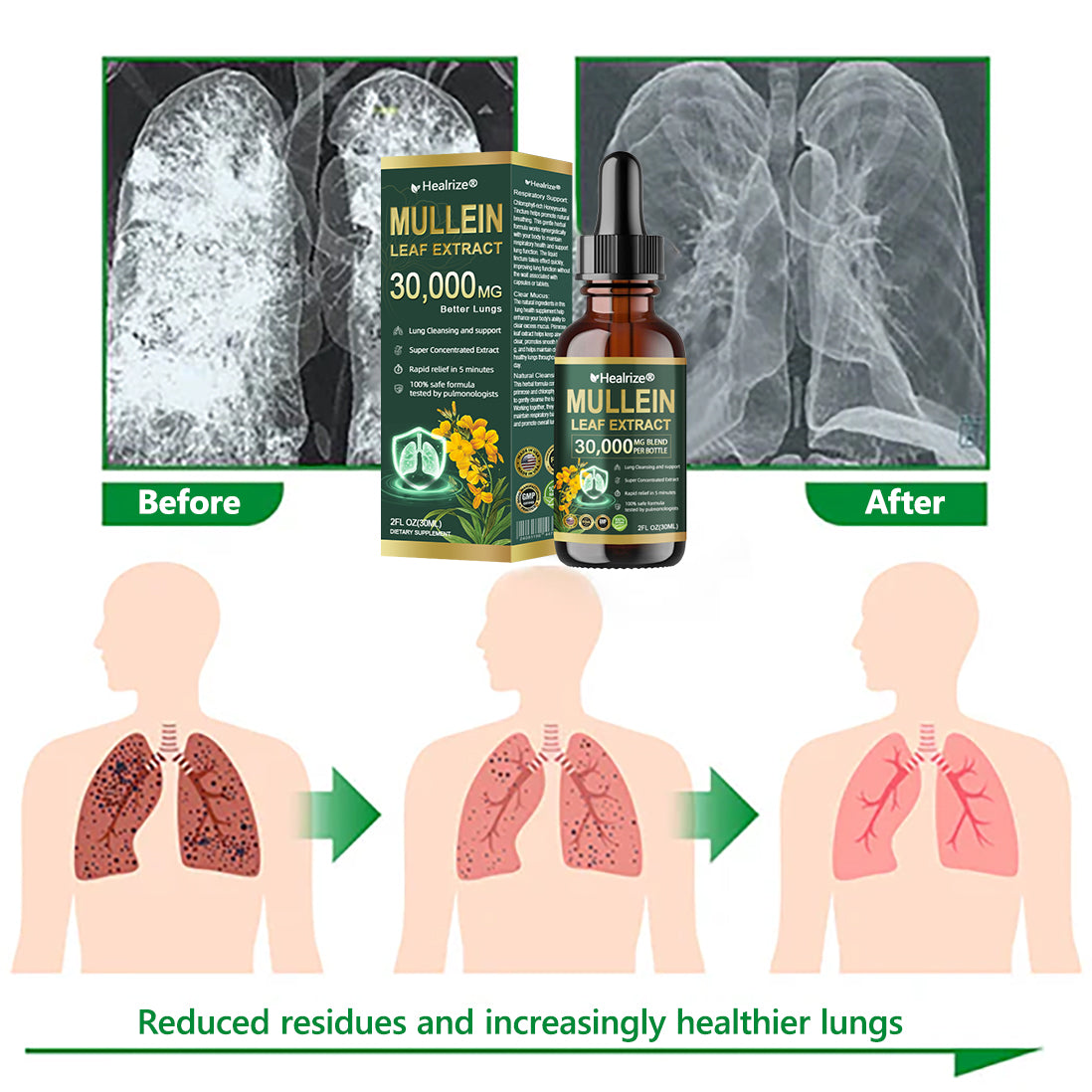𝗢𝗳𝗳𝗶𝗰𝗶𝗮𝗹 | Healrize® 𝗢𝗿𝗴𝗮𝗻𝗶𝗰 𝗟𝘂𝗻𝗴 𝗖𝗹𝗲𝗮𝗻𝘀𝗶𝗻𝗴 𝗠𝘂𝗹𝗹𝗲𝗶𝗻 𝗟𝗲𝗮𝗳 𝗘𝘅𝘁𝗿𝗮𝗰𝘁 𝗗𝗿𝗼𝗽𝘀 🌎 𝐂𝐥𝐢𝐧𝐢𝐜𝐚𝐥𝐥𝐲 𝐩𝐫𝐨𝐯𝐞𝐧, 𝐡𝐢𝐠𝐡𝐥𝐲 𝐜𝐨𝐧𝐜𝐞𝐧𝐭𝐫𝐚𝐭𝐞𝐝 𝐟𝐨𝐫𝐦𝐮𝐥𝐚 𝐭𝐡𝐚𝐭 𝐫𝐞𝐥𝐢𝐞𝐯𝐞𝐬 𝐜𝐨𝐮𝐠𝐡, 𝐩𝐡𝐥𝐞𝐠𝐦, 𝐚𝐬𝐭𝐡𝐦𝐚 & 𝐂𝐎𝐏𝐃 — 𝐛𝐫𝐞𝐚𝐭𝐡𝐞 𝐞𝐚𝐬𝐢𝐞𝐫, 𝐟𝐚𝐬𝐭𝐞𝐫.🇺🇸
