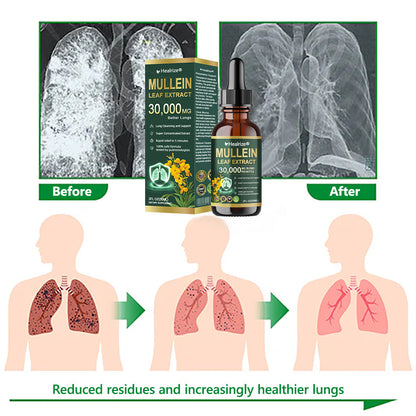 𝗢𝗳𝗳𝗶𝗰𝗶𝗮𝗹 | Healrize® 𝗢𝗿𝗴𝗮𝗻𝗶𝗰 𝗟𝘂𝗻𝗴 𝗖𝗹𝗲𝗮𝗻𝘀𝗶𝗻𝗴 𝗠𝘂𝗹𝗹𝗲𝗶𝗻 𝗟𝗲𝗮𝗳 𝗘𝘅𝘁𝗿𝗮𝗰𝘁 𝗗𝗿𝗼𝗽𝘀 🌎 𝐂𝐥𝐢𝐧𝐢𝐜𝐚𝐥𝐥𝐲 𝐩𝐫𝐨𝐯𝐞𝐧, 𝐡𝐢𝐠𝐡𝐥𝐲 𝐜𝐨𝐧𝐜𝐞𝐧𝐭𝐫𝐚𝐭𝐞𝐝 𝐟𝐨𝐫𝐦𝐮𝐥𝐚 𝐭𝐡𝐚𝐭 𝐫𝐞𝐥𝐢𝐞𝐯𝐞𝐬 𝐜𝐨𝐮𝐠𝐡, 𝐩𝐡𝐥𝐞𝐠𝐦, 𝐚𝐬𝐭𝐡𝐦𝐚 & 𝐂𝐎𝐏𝐃 — 𝐛𝐫𝐞𝐚𝐭𝐡𝐞 𝐞𝐚𝐬𝐢𝐞𝐫, 𝐟𝐚𝐬𝐭𝐞𝐫.🇺🇸