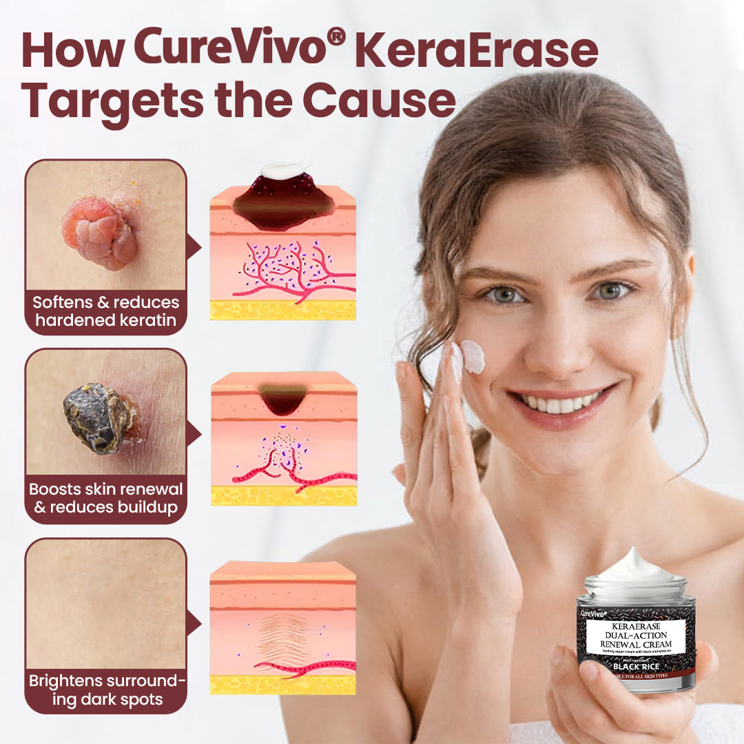 70% 𝑶𝒇𝒇𝒊𝒄𝒊𝒂𝒍 𝒔𝒕𝒐𝒓𝒆📢𝑪𝒖𝒓𝒆𝑽𝒊𝒗𝒐® KeraErase Dual-Action Renewal Cream