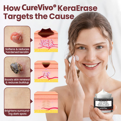 70% 𝑶𝒇𝒇𝒊𝒄𝒊𝒂𝒍 𝒔𝒕𝒐𝒓𝒆📢𝑪𝒖𝒓𝒆𝑽𝒊𝒗𝒐® KeraErase Dual-Action Renewal Cream