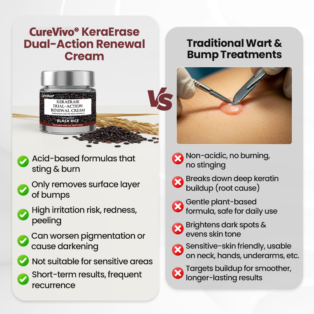 70% 𝑶𝒇𝒇𝒊𝒄𝒊𝒂𝒍 𝒔𝒕𝒐𝒓𝒆📢𝑪𝒖𝒓𝒆𝑽𝒊𝒗𝒐® KeraErase Dual-Action Renewal Cream