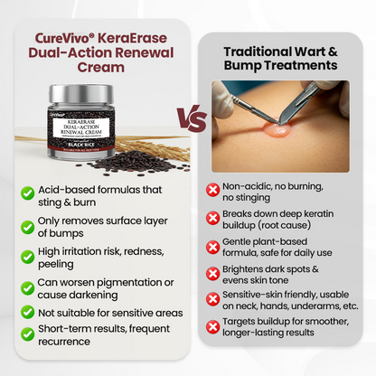 70% 𝑶𝒇𝒇𝒊𝒄𝒊𝒂𝒍 𝒔𝒕𝒐𝒓𝒆📢𝑪𝒖𝒓𝒆𝑽𝒊𝒗𝒐® KeraErase Dual-Action Renewal Cream