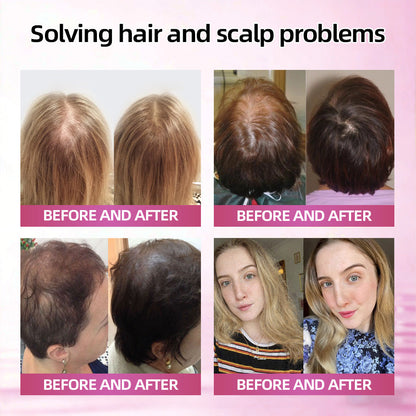 𝗙𝗗𝐀-𝐑𝐞𝗴𝗶𝘀𝘁𝐞𝐫𝐞𝗱 & 𝐆𝗠𝐏 𝗖𝗲𝗿𝐭𝐢𝐟𝐢𝐞𝗱👩‍⚕️✨  | 🇺🇸CureVivo® High-Concentrate Molecular Repair Essence | ✅ Clinical Grade | Peptide 78 Bio-Active Formula | Results in 7 Days